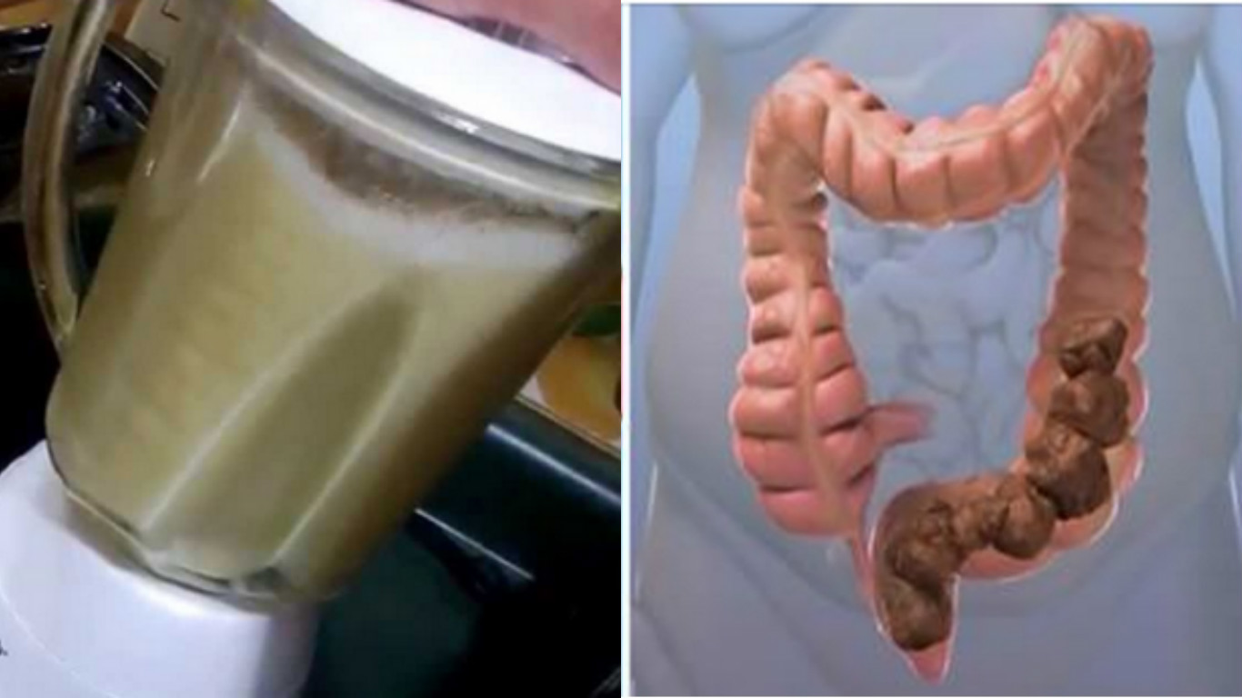 7 Poderosos Remedios Caseros Para El Colon Irritable