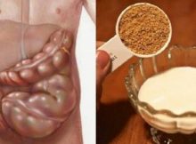 Estos dos ingredientes eliminaran las libras de toxinas de tus intestinos!
