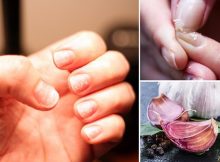 Cómo tener uñas más fuertes con el uso del ajo. Facil y sensillo
